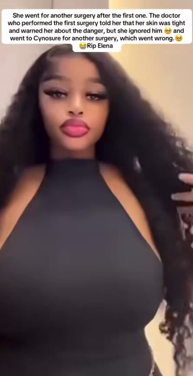 Tragic Death Exposes The Dark Side Of Cosmetic Surgery Trends