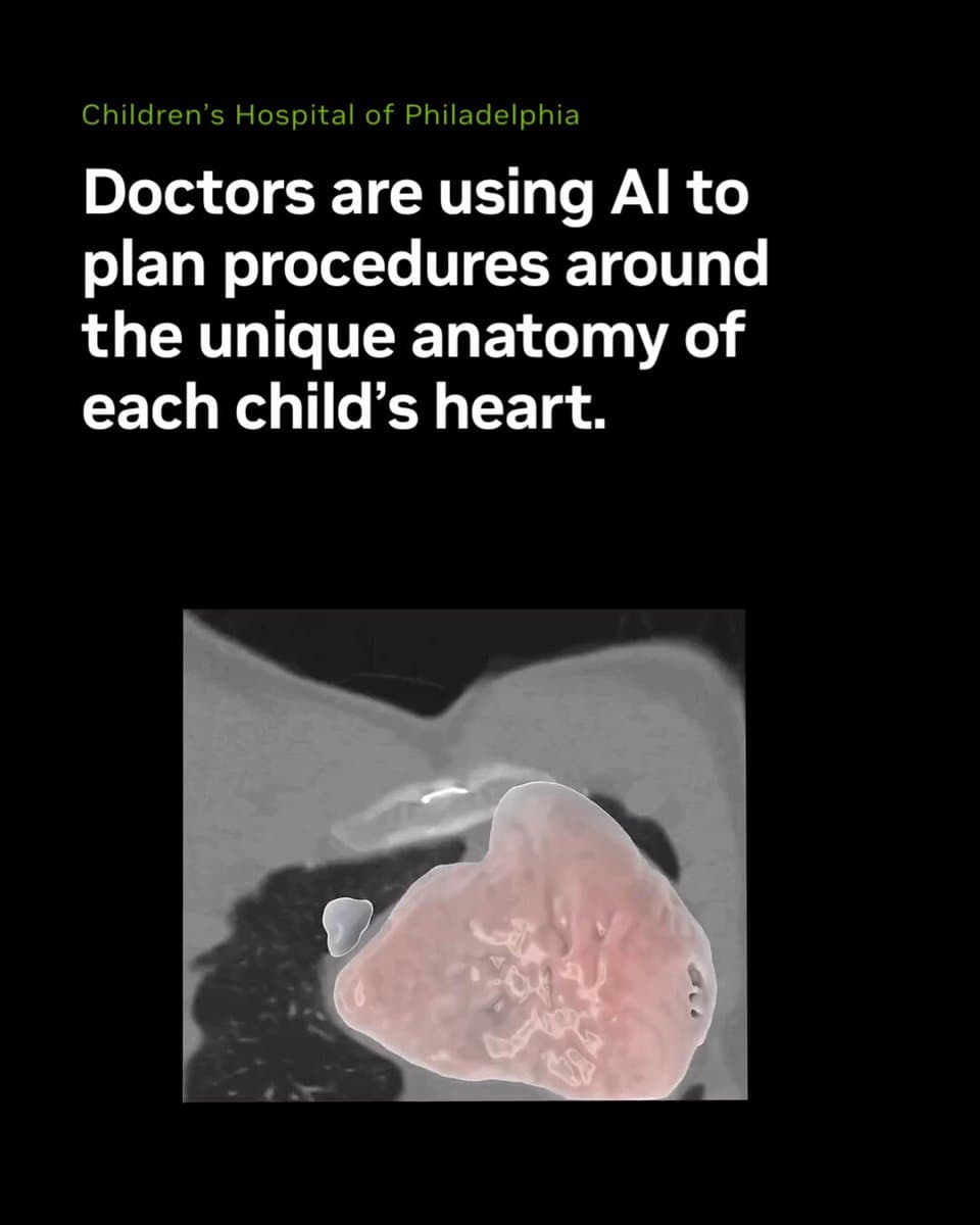 AI Teaches Doctors To Map Each Child's Heart Before Surgery