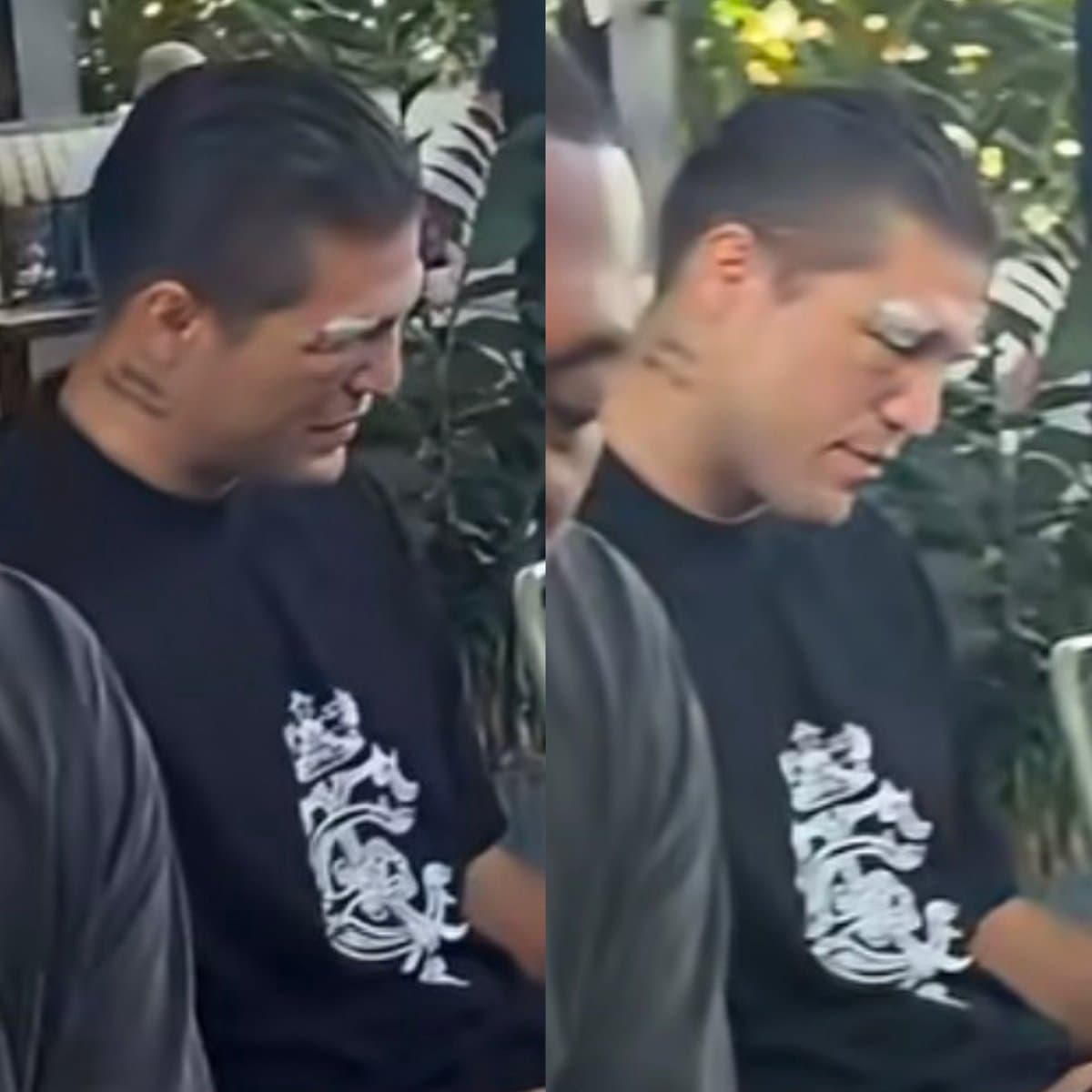 Brian Ortega Photo Sparks Concern Among MMA Fans
